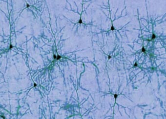 Group of neurons